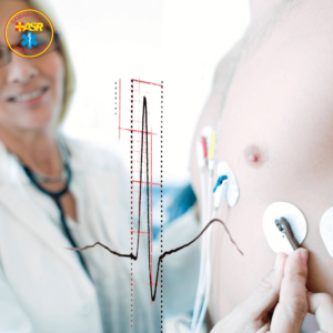 consultații medicale la domiciliu electrocardiograma